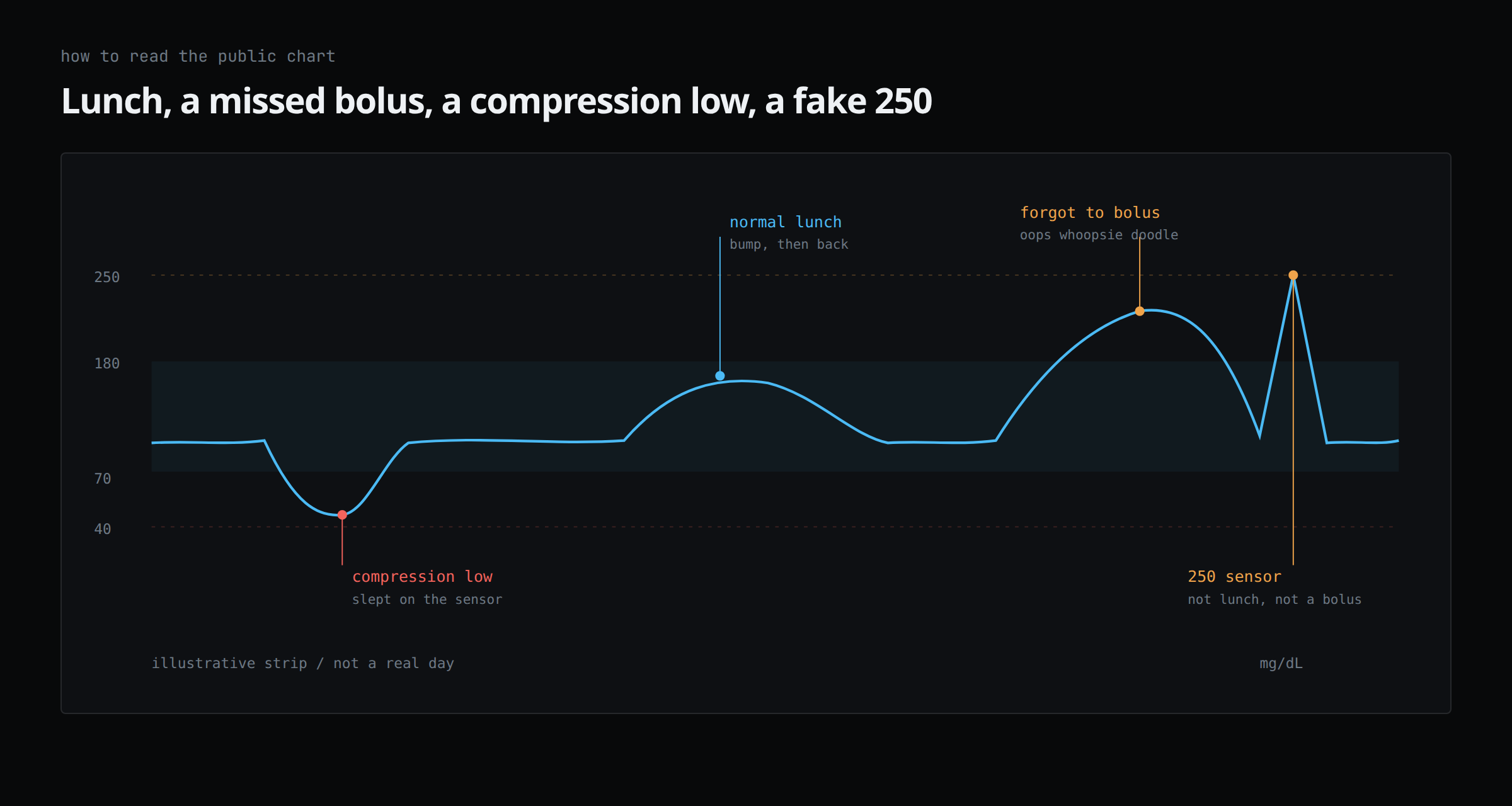 Illustrative strip showing a compression low, a normal lunch bump, a missed-bolus meal spike, and a sudden 250 sensor cliff.
